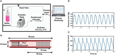 Design and Verification of a Novel Perfusion Bioreactor to Evaluate the Performance of a Self-Expanding Stent for Peripheral Artery Applications